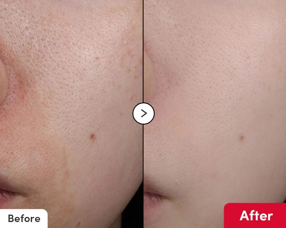 EQUAL BERRY Deep Care Vitamin Illuminating Serum